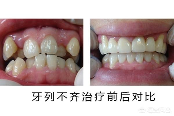 图木舒克最新24小时牙医在线咨询方法分析(最方便真实的图木舒克有没有24小时牙医方法)