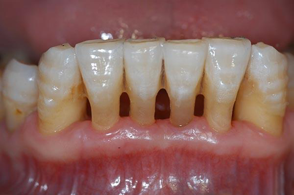 图木舒克最新24小时牙医在线咨询方法分析(最方便真实的图木舒克有没有24小时牙医方法)